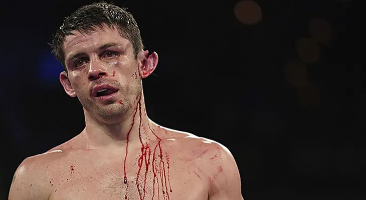 La escalofriante consecuencia de la derrota de un boxeador: a punto de perder una oreja por los golpes