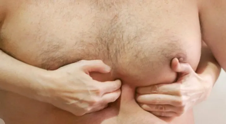 5 remedios naturales para la hernia de hiato