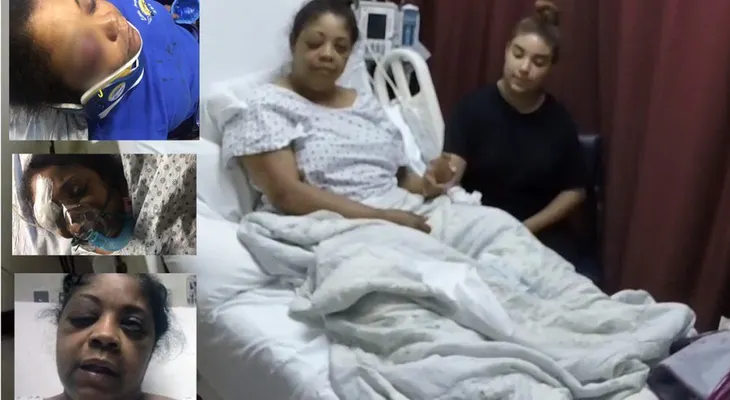 Conductora dominicana Loraine Santana podría perder un ojo por la golpiza que le dio una pareja 