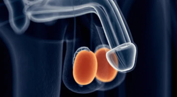 Síndrome de Klinefelter: no producir testosterona tiene serias implicaciones para los hombres