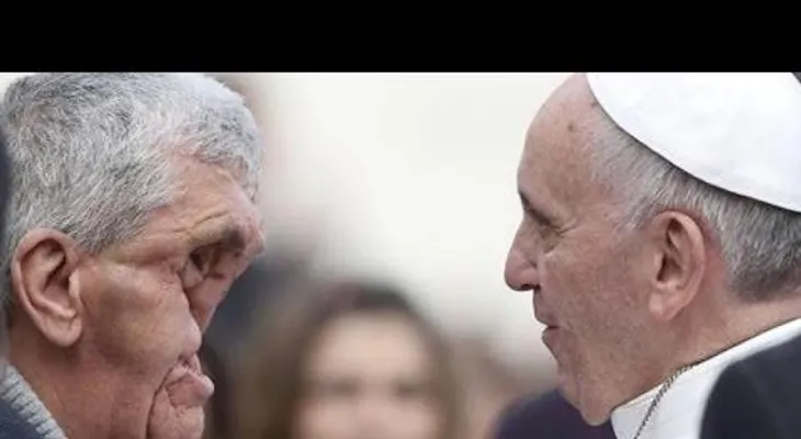 El papa abraza a un hombre con el rostro completamente desfigurado