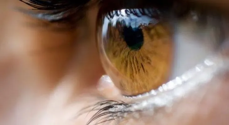 Edema macular suele asociarse a la Diabetes