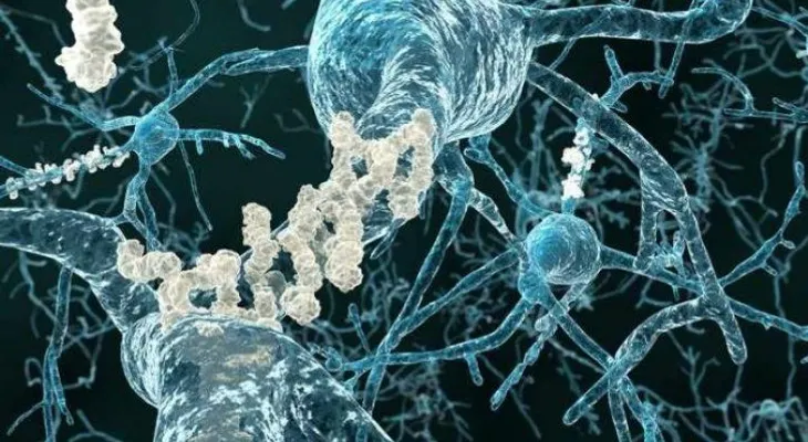 ¿Desea que su cerebro sea sano? Lleve una vida sana