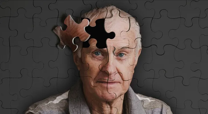 Descubren el origen del Alzheimer y el hallazgo sorprendió