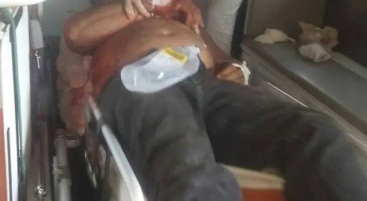 Mujer apuñala hombre que se negó a pagar cervezas 
