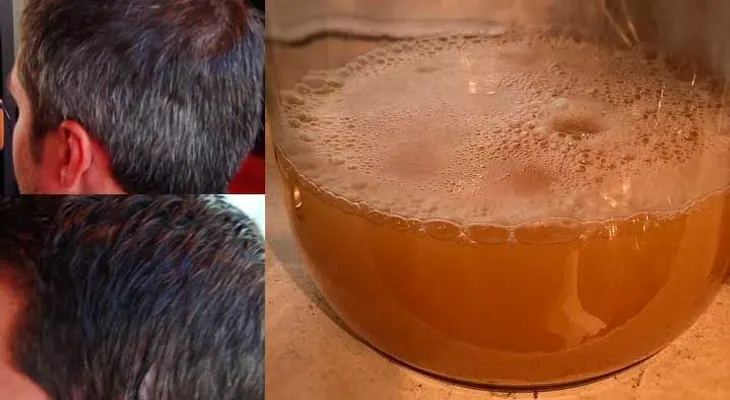 Ya no tengo que usar tinte nunca más. Desde que comencé este tratamiento mi canas desaparecieron por completo