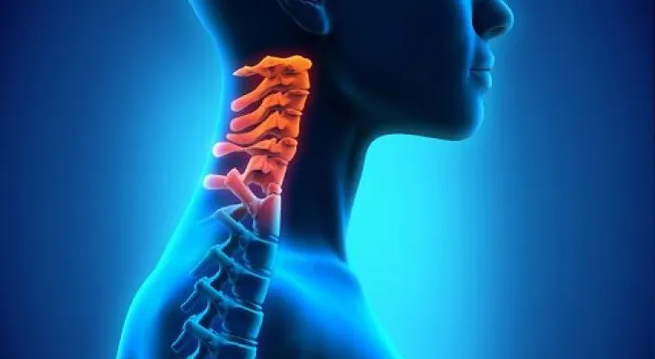 Espondilosis cervical: síntomas y tratamientos naturales