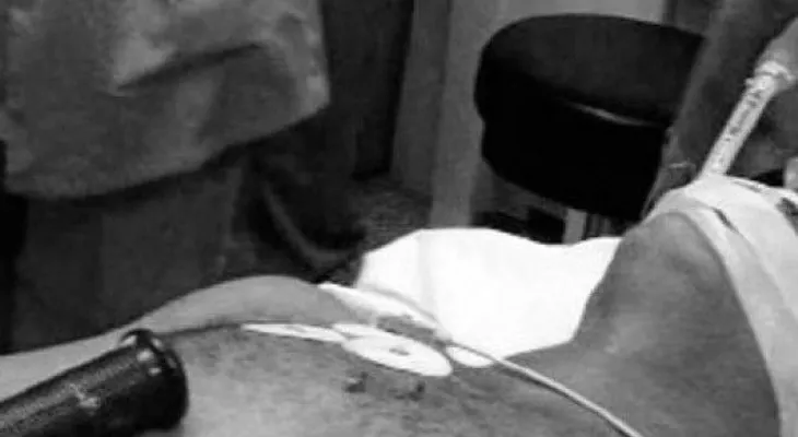 Hombre muere al incrustarsele un pedazo de una pulidora en el pecho 