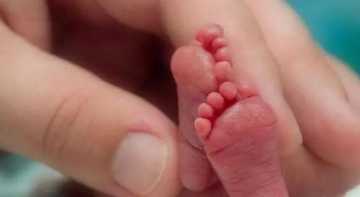 Estadística de recién nacidos prematuros es un problema de salud mundial