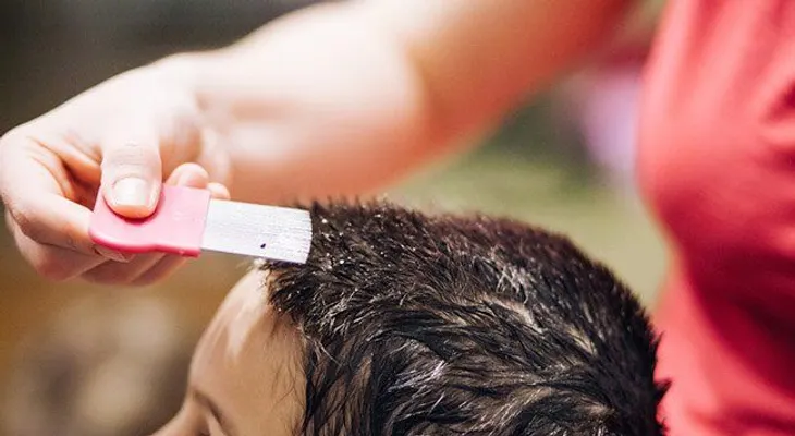 Cómo usar el vinagre para eliminar piojos y las liendres 