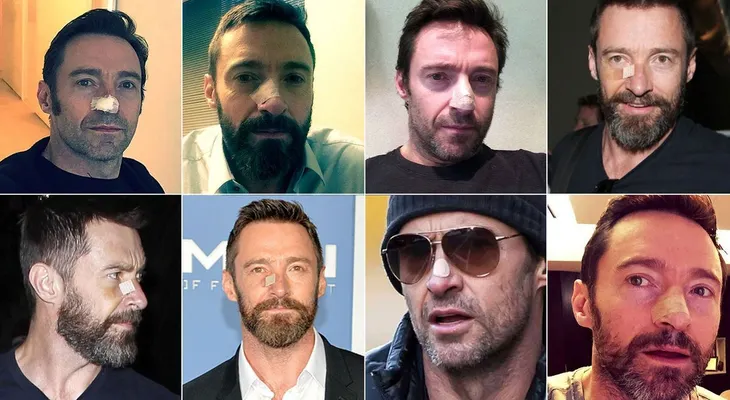 Hugh Jackman confirmó que vuelve a padecer cáncer