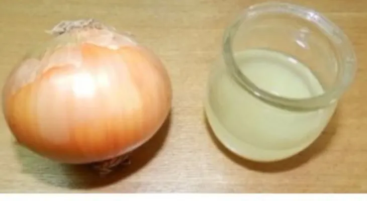 5 importantes remedios para acelerar el crecimiento del cabello y parar su caída
