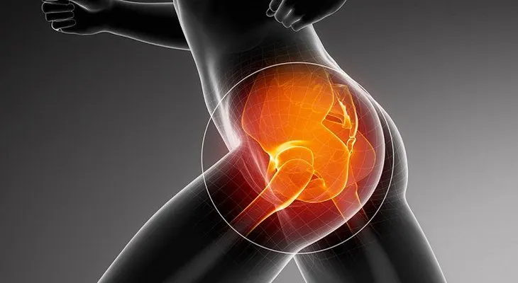 8 razones para el dolor de cadera y cómo evitar medicamentos