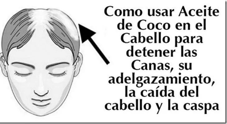 Increible aceite que hace desaparecer la calvicie y combate la caspa. Crece el cabello desde la primera aplicación