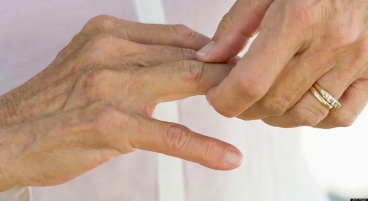 Remedios naturales contra la artritis