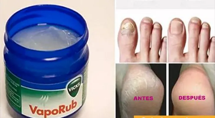 Por qué nadie me lo había dicho: 13 usos increíbles del VICKS VAPORUB