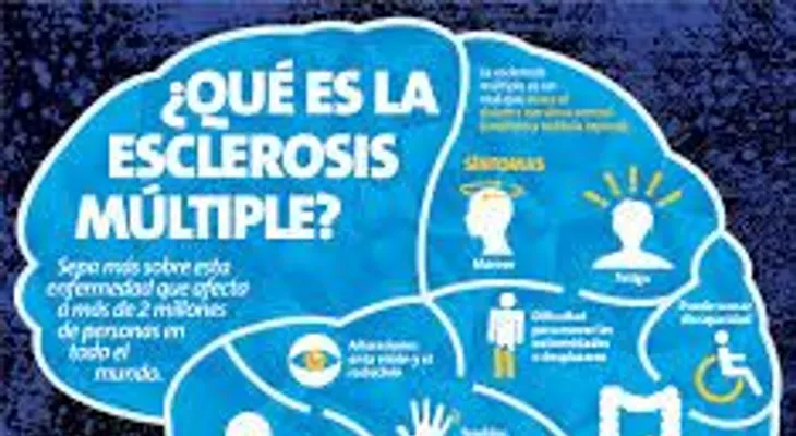 Conoce estos efectivos remedios para la esclerosis múltiple 