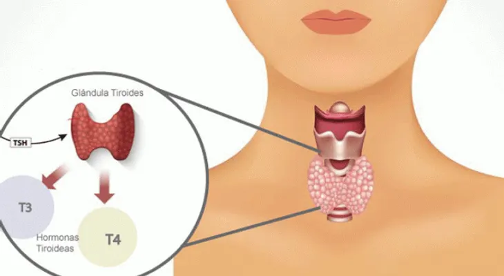 La guía completa de tus hormonas tiroideas ¿Qué es la T3 y T4?