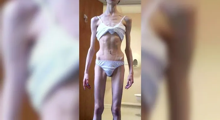 Increíble transformación: de la anorexia a ser luchadora de artes marciales mixtas