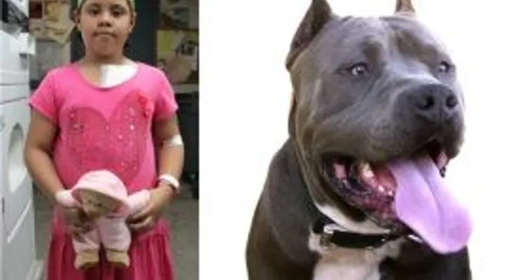 Niña dominicana sobrevive al fiero ataque de un Pit Bull en edificio del Alto Manhattan 