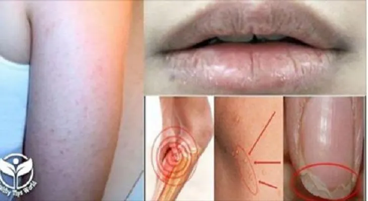 Si está perdiendo cabello, descubre la vitamina que te hace falta