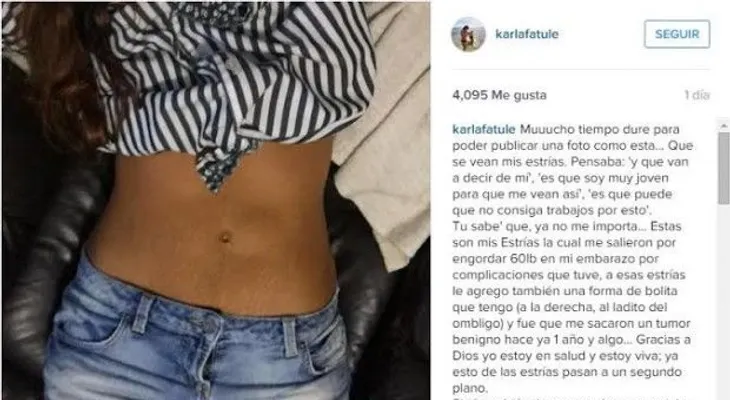Karla Fatule publica foto en Instagram donde muestra sus estrías