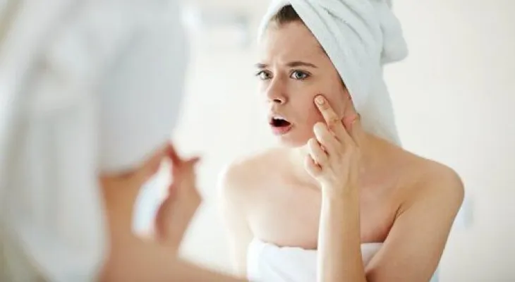 5 aceites esenciales para combatir el acné