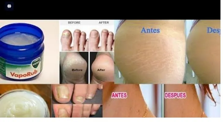 13 usos increíbles Vicks VapoRub que Te Sorprenderán