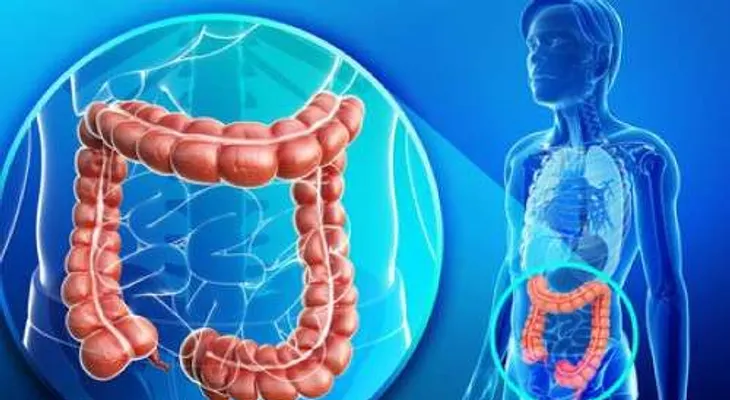 Consejos para tratar el sobrepeso y colon intoxicado