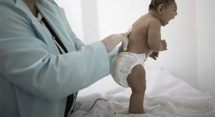 ¿Pueden los científicos vincular el zika y la microcefalia?