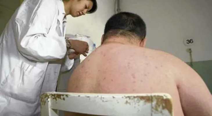 Divulga nuevas pautas para evitar la obesidad