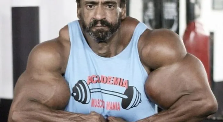 El hombre que se inyecta aceite en los bíceps para parecerse a Hulk 
