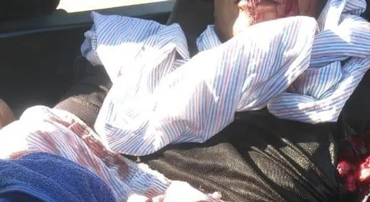 Un hombre recibe varios machetazos, tras reclamarle a otro por el robo de víveres 