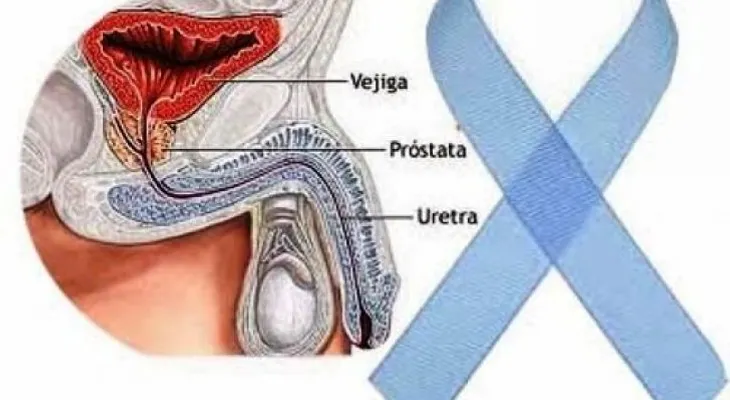 La ciencia busca favorecer a los pacientes con cáncer en su diagnóstico