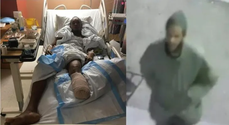 Dominicano acusado de empujar compatriota a vías del tren pierde parte de una pierna