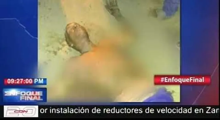 Se encuentra en situación grave de salud, joven que se prendió fuego porque su pareja lo abandonó