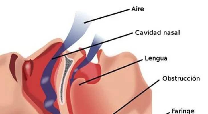 Siete tips para dejar de roncar