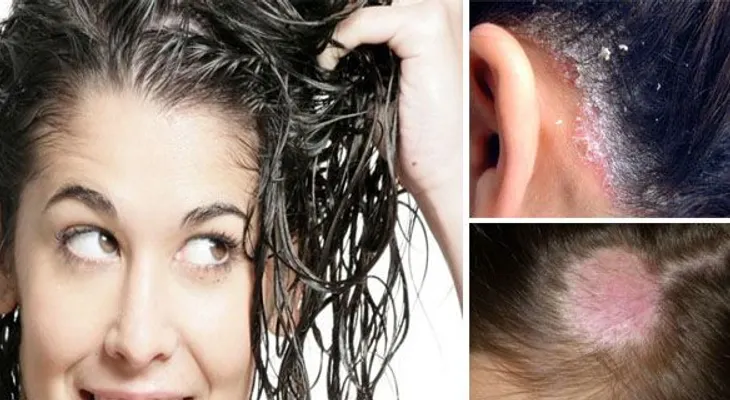 6 enfermedades que son causadas por dormir con el cabello mojado