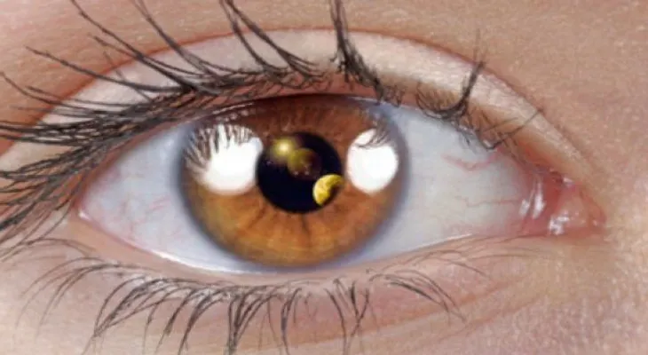 Ojeras: Qué las causa y cómo eliminarlas