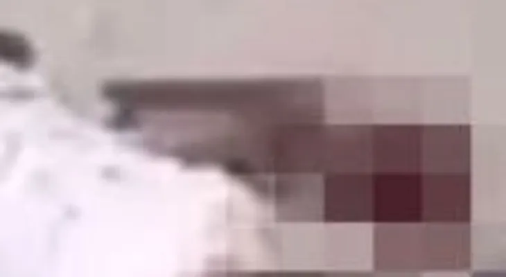 Un niño atacado por 11 perros agoniza en la calle y nadie le presta atención hasta que muere