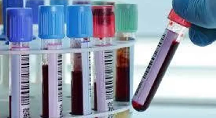 Tratamientos innovadores ayudan a evitar sangrados en pacientes con hemofilia