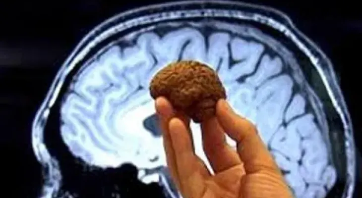 ¿Qué efectos causa en el cerebro comer cacao o chocolate?
