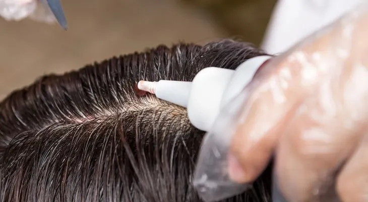 Oncólogo Héctor Manuel Rosario recomienda evitar el tintes en el cabello 