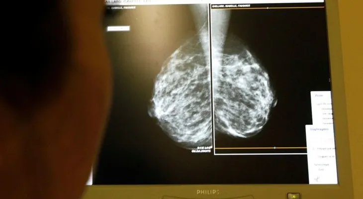 Un simple suplemento puede detener el cáncer (VIDEO)