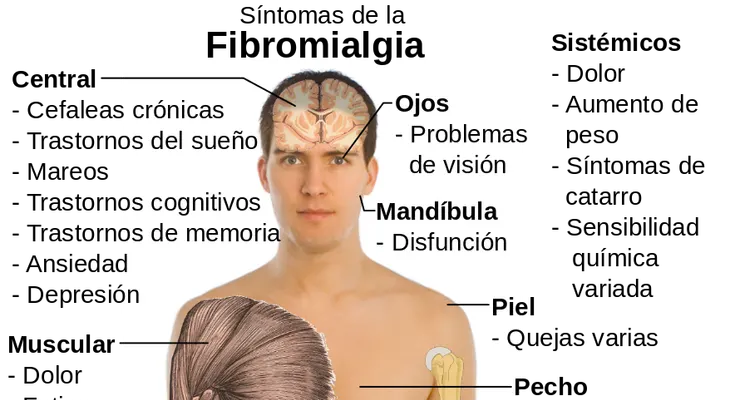 10 Hierbas recomendas para tratar la Fibromialgia