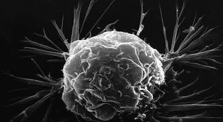 Eliminar ciertos aminoácidos en la dieta podría ayudar a combatir el cáncer