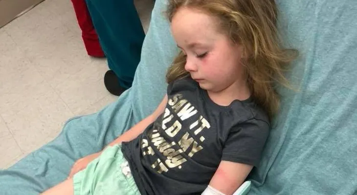 Su hija de 5 años sufrió una parálisis y supo de qué se trataba revisando su cabello