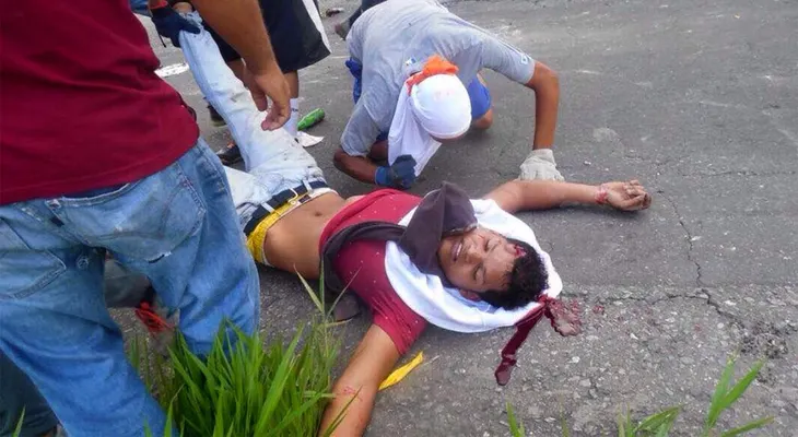 IMAGENES FUERTES: Otro disparo en la cabeza durante la represión del régimen militar de Maduro a las manifestaciones civiles
