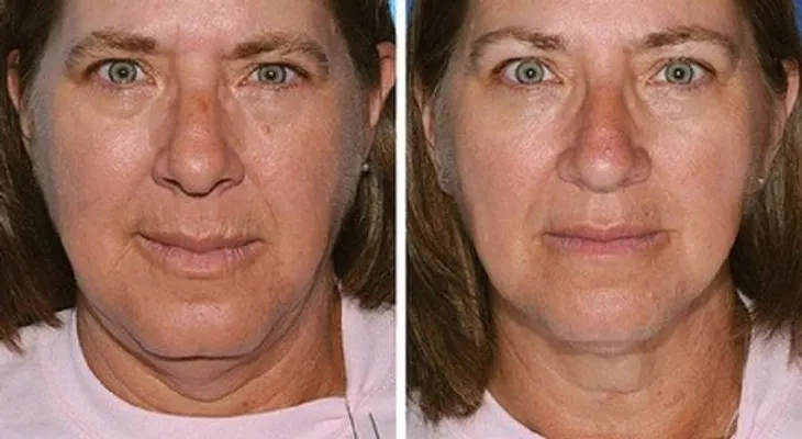 Fotos de gemelos muestran cómo fumar afecta al rostro