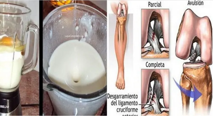 Esta mujer eliminó su dolor de rodillas y articulaciones en 1 día sin ir al doctor por ella misma!!!?